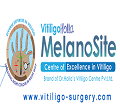 Melanosite Bangalore